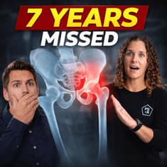 Why Hip Dysplasia Goes Undiagnosed for 7 Years