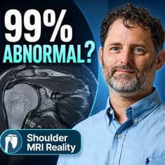 Dr. Thomas Ibounig on Incidental Rotator Cuff Abnormalities and Shoulder MRI