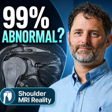 Dr. Thomas Ibounig on Incidental Rotator Cuff Abnormalities and Shoulder MRI