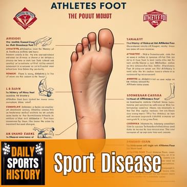Untold History of Athlete’s Foot: From Ancient Egypt to Modern Sports