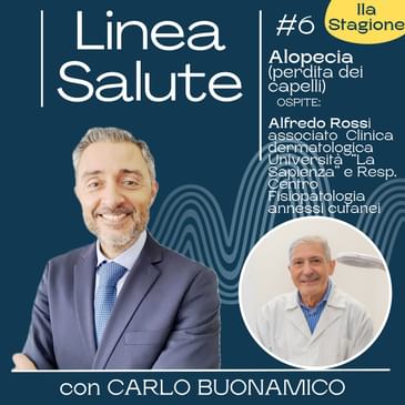 Alopecia: talvolta sinonimo di sensualità, può causare anche imbarazzo