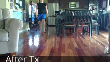 Slow Motion Gait - Right Foot Pain Before and After Treatment