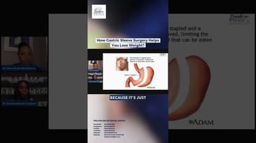 How Gastric Sleeve Surgery Helps You Lose Weight? #weightloss #youtubeshorts #shorts