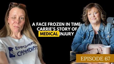A Face Frozen In Time: Carrie’s Story Of Medical Injury