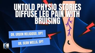 Untold Physio Stories Podcast - Diffuse Leg Pain with Bruising