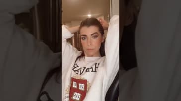 Postpartum Hair Loss #shorts #mom #postpartum