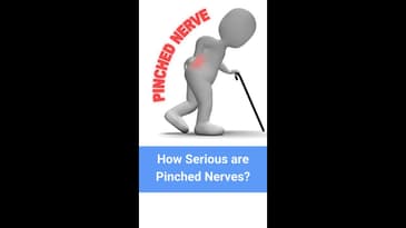 How Serious are Pinched Nerves?