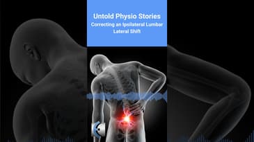 Untold Physio Stories - Correcting an Ipsilateral Lumbar Lateral Shift