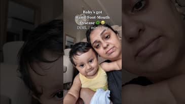 So painful to watch your baby going through this terrible hand foot mouth virus! 🦠 #momlifewithac