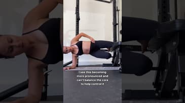 Coning & Doming while pregnant