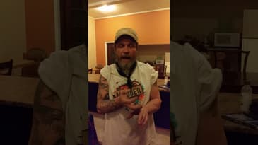 Man with holes in his Biceps Healed