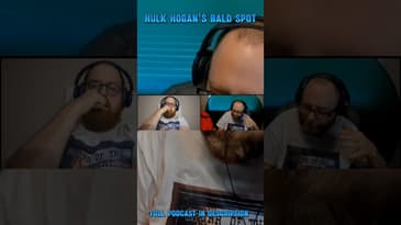Hulk Hogan's Bald Spot
