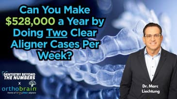 Unlock Your Practice's Potential: The Profit-Boosting Power of Clear Aligners with OrthoBrain