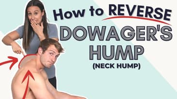 Dowager's Hump  | How do I reverse this hump?