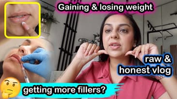 LIFE UPDATE: About My Fillers, Weight Gain & Overall Mental Health Update | Aanam C