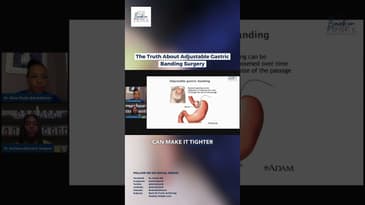 The Truth About Adjustable Gastric Banding Surgery #gastric #youtubeshorts #shorts