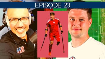 WORLD CUP AMPUTEE  Liam Burbridge