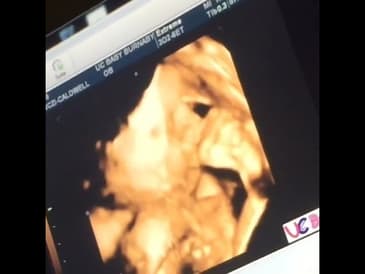 Perks of having an Athletic and Flexible parents! I got this from them! #shorts #baby #ultrasound