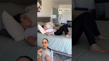 Diastasis Recti during pregnancy