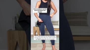 C-section Scar Tissue Healing