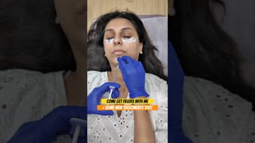 GETTING NEW FILLERS #MiniVlog