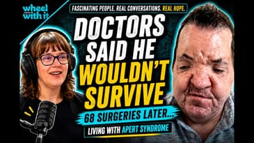 Doctors Said He Wouldn’t Live Past 18 | Dorsey Ross’s Incredible Story of Faith & Apert Syndrome