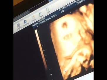 FYI moms that want a 3D image get them done at 32 weeks to max 35 weeks! #shorts #baby #momlife