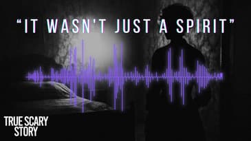 Teeth: The Horrors of Living With a Mimic (True Caller Recording) - True Scary Story