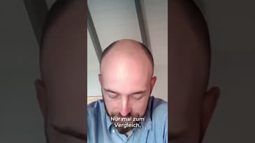 Im Goldstandard waren die Preise stabil