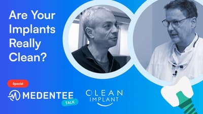 A Glimpse into Tomorrow's Smiles: Clean Dental Implants | Special Medentee Talk 🦷