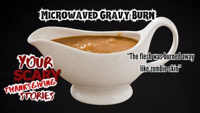 Gravy Burn on Thanksgiving