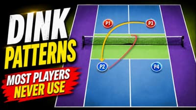 The Dink Patterns Most Players Never Use