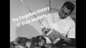 The Forgotten History Of Brain Implants...