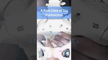 Untold Physio Stories Podcast - A Rare Case of SIJ Dysfunction