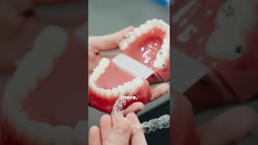 Candid At The Dentist Office #friends