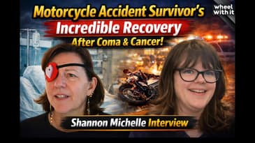 Motorcycle Accident Survivor’s Incredible Recovery After Coma & Cancer | Shannon Michelle Interview