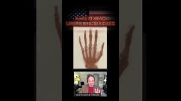 Nikola Tesla Accidently Discovered Xrays #shorts