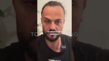 Bunions Aren't Just Genetic! #bunions #foothealth