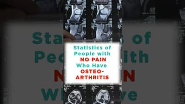 Arthritis Doesn't Equal Pain!