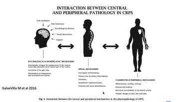 Complex Regional Pain Syndrome