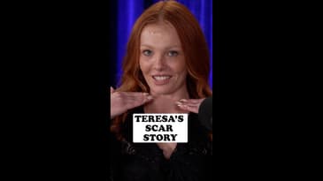 Teresa shares her scar story