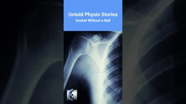 Untold Physio Stories - Socket Without a Ball