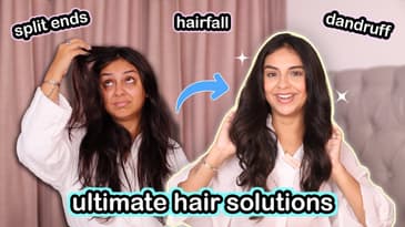 HOW TO TREAT Hair Fall & Dandruff At Home | ULTIMATE SOLUTION! | Aanam C