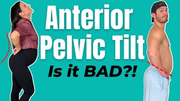 Is Anterior Pelvic Tilt bad?