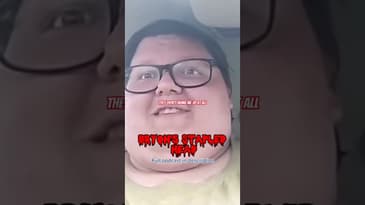 Bryon’s stapled head