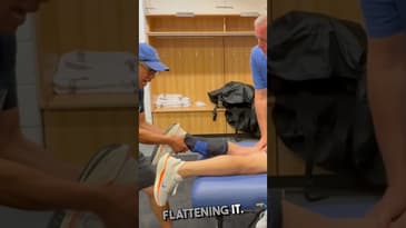 Restoring Terminal Knee Extension  for Post Op Function