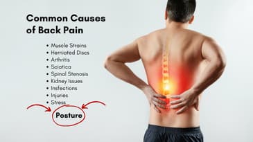 Unlocking the Secrets to End Lower Back Pain: Fix Muscle Imbalance and Posture for Lasting Relief!