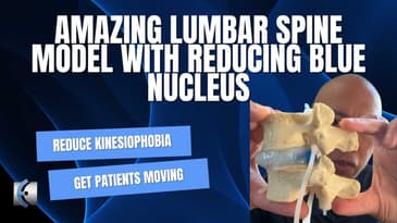 Amazing Lumbar Disc Model with Reducing Blue Nucleus