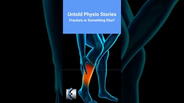 Untold Physio Stories - Fracture or Something Else?