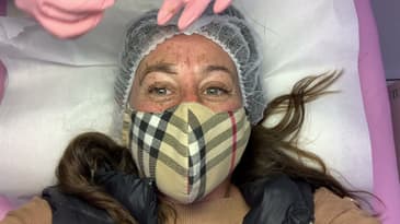 Micro-blading Eyebrows